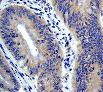 Immunohistochemistry (Formalin/PFA-fixed paraffin-embedded sections) - Anti-APC antibody [EP701Y] - BSA and Azide free (AB239828)