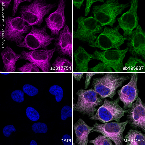Immunocytochemistry/ Immunofluorescence - APC Anti-beta Tubulin antibody [EPR16774] (ab317754), expandable thumbnail