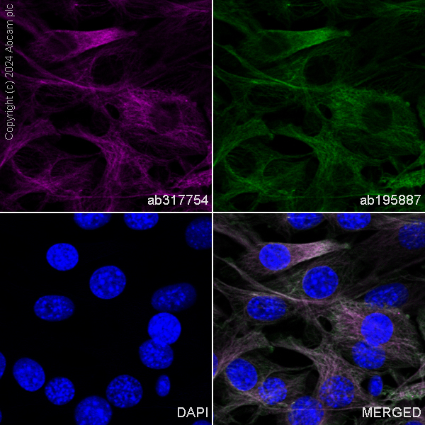 Immunocytochemistry/ Immunofluorescence - APC Anti-beta Tubulin antibody [EPR16774] (AB317754), expandable thumbnail
