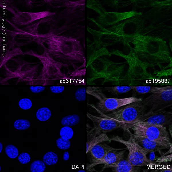 Immunocytochemistry/ Immunofluorescence - APC Anti-beta Tubulin antibody [EPR16774] - Microtubule Marker (AB317754)