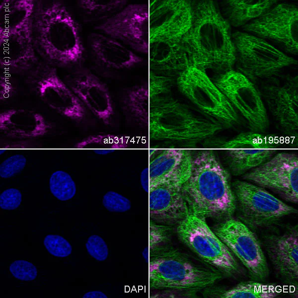 APC Anti-Cardiac Troponin T抗体[EPR20266] (ab317475)| Abcam中文官网