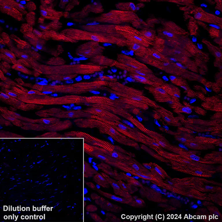 Immunohistochemistry (Formalin/PFA-fixed paraffin-embedded sections) - APC Anti-Cardiac Troponin T antibody [EPR20266] (AB317475)