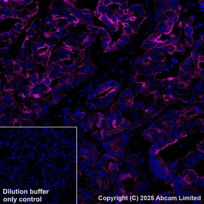 Immunohistochemistry paraffin embedded sections - APC Anti-Cytokeratin 19 antibody [EPR1579Y] (AB221255)