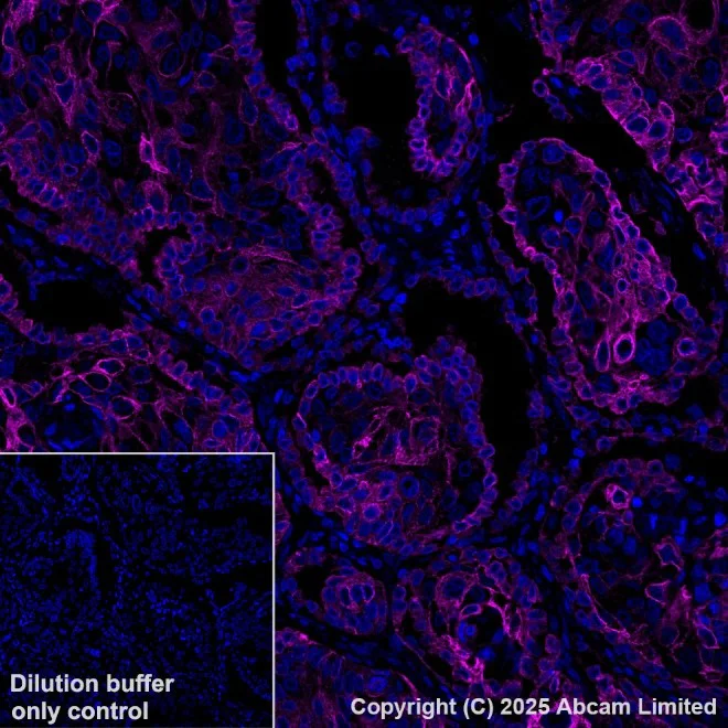 Immunohistochemistry paraffin embedded sections - APC Anti-Cytokeratin 19 antibody [EPR1579Y] (AB221255)