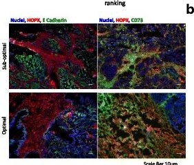 Immunohistochemistry - APC Anti-E Cadherin antibody [67A4] (AB99885)