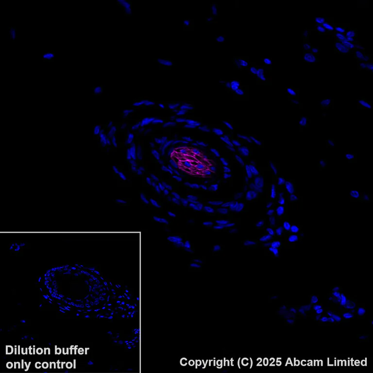 Immunohistochemistry (Formalin/PFA-fixed paraffin-embedded sections) - APC Anti-GPCR GPRC5D antibody [EPR28376-41] (AB323443)