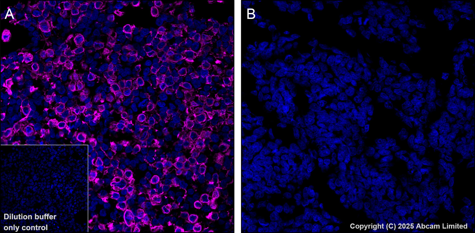 Immunohistochemistry (Formalin/PFA-fixed paraffin-embedded sections) - APC Anti-GPCR GPRC5D antibody [EPR28376-41] (AB323443), expandable thumbnail