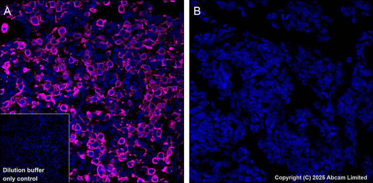 Immunohistochemistry (Formalin/PFA-fixed paraffin-embedded sections) - APC Anti-GPCR GPRC5D antibody [EPR28376-41] (AB323443)