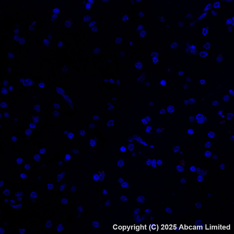 Immunohistochemistry (Formalin/PFA-fixed paraffin-embedded sections) - APC Anti-GPCR GPRC5D antibody [EPR28376-41] (AB323443), expandable thumbnail