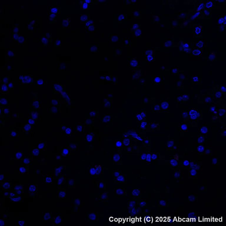 Immunohistochemistry (Formalin/PFA-fixed paraffin-embedded sections) - APC Anti-GPCR GPRC5D antibody [EPR28376-41] (AB323443)