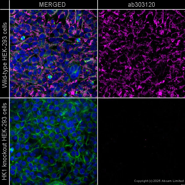 Immunocytochemistry/ Immunofluorescence - APC Anti-Hexokinase 1 - Mitochondrial Outer Membrane Marker antibody [EPR10134(B)] (AB303120)
