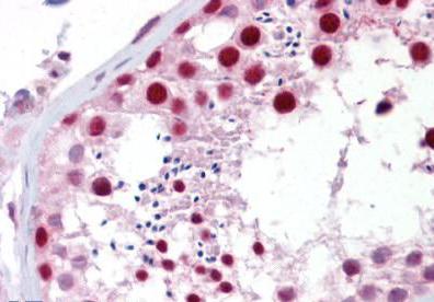 Immunohistochemistry (Formalin/PFA-fixed paraffin-embedded sections) - Anti-Apc1 antibody (AB133397)