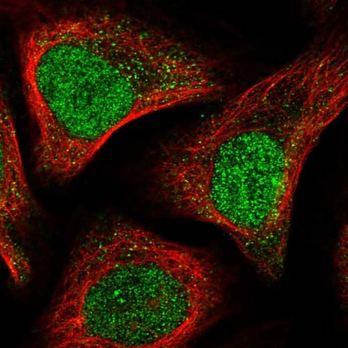 Immunocytochemistry/ Immunofluorescence - Anti-APC15 antibody (AB122349)