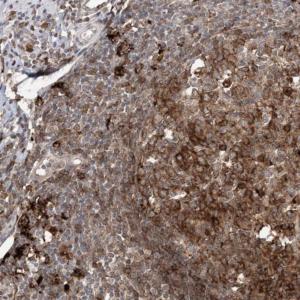 Immunohistochemistry (Formalin/PFA-fixed paraffin-embedded sections) - Anti-APC15 antibody (AB122349)
