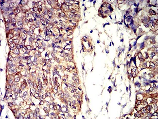 Immunohistochemistry (Formalin/PFA-fixed paraffin-embedded sections) - Anti-APC2 antibody [3A2G2] (AB233753)