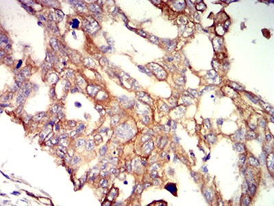 Immunohistochemistry (Formalin/PFA-fixed paraffin-embedded sections) - Anti-APC2 antibody [3A2G2] (AB233753), expandable thumbnail