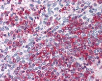 Immunohistochemistry (Formalin/PFA-fixed paraffin-embedded sections) - Anti-Apc4 antibody (AB113364)