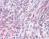 Immunohistochemistry (Formalin/PFA-fixed paraffin-embedded sections) - Anti-Apc4 antibody (AB113364)