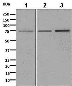 Western blot - Anti-Apc6 antibody [EPR11168] (AB169536)