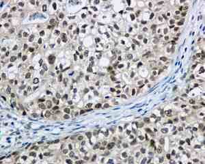 Immunohistochemistry (Formalin/PFA-fixed paraffin-embedded sections) - Anti-Apc6 antibody [EPR11168] - BSA and Azide free (AB249488), expandable thumbnail