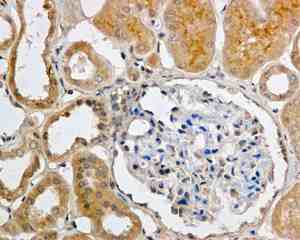 Immunohistochemistry (Formalin/PFA-fixed paraffin-embedded sections) - Anti-Apc6 antibody [EPR11168] - BSA and Azide free (AB249488), expandable thumbnail