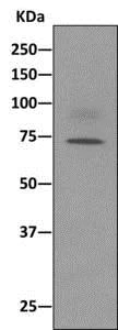 Western blot - Anti-Apc6 antibody [EPR11168] - BSA and Azide free (AB249488)
