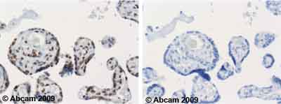 Immunohistochemistry (Formalin/PFA-fixed paraffin-embedded sections) - Anti-APE1 antibody [13B8E5C2] (AB194)