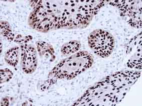 Immunohistochemistry (Formalin/PFA-fixed paraffin-embedded sections) - Anti-APE1 antibody (AB137708), expandable thumbnail