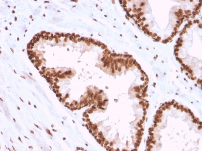 Immunohistochemistry (Formalin/PFA-fixed paraffin-embedded sections) - Anti-APE1 antibody [CPTC-APEX1-2] (AB268072), expandable thumbnail