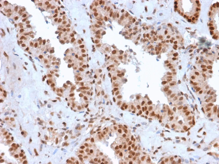 Immunohistochemistry (Formalin/PFA-fixed paraffin-embedded sections) - Anti-APE1 antibody [CPTC-APEX1-2] - BSA and Azide free (AB268193)
