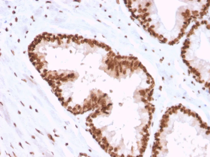 Immunohistochemistry (Formalin/PFA-fixed paraffin-embedded sections) - Anti-APE1 antibody [CPTC-APEX1-2] - BSA and Azide free (AB268193)