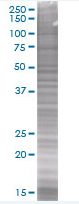 APE1 overexpression 293T lysate (whole cell)