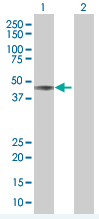 Western blot - APE1 overexpression 293T lysate (whole cell) (AB94250)