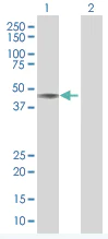 Western blot - APE1 overexpression 293T lysate (whole cell) (AB94250)