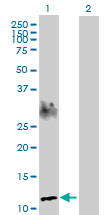 Western blot - Anti-APEG1 antibody (AB168746)