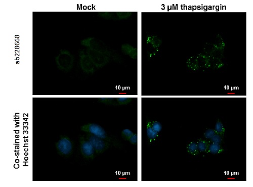 Immunocytochemistry/ Immunofluorescence - Anti-APG5L/ATG5 antibody (AB228668)