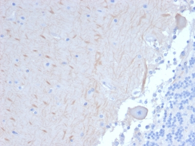 Immunohistochemistry (Formalin/PFA-fixed paraffin-embedded sections) - Anti-APG5L/ATG5 antibody [ATG5/2101] (AB238092)