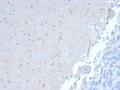 Immunohistochemistry (Formalin/PFA-fixed paraffin-embedded sections) - Anti-APG5L/ATG5 antibody [ATG5/2101] (AB238092)