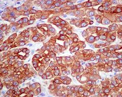 Immunohistochemistry (Formalin/PFA-fixed paraffin-embedded sections) - Anti-APG5L/ATG5 antibody [EPR1755(2)] (AB108327)