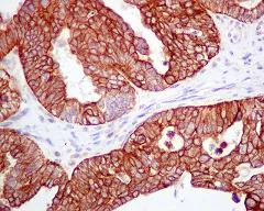 Immunohistochemistry (Formalin/PFA-fixed paraffin-embedded sections) - Anti-APG5L/ATG5 antibody [EPR1755(2)] - BSA and Azide free (AB221604)