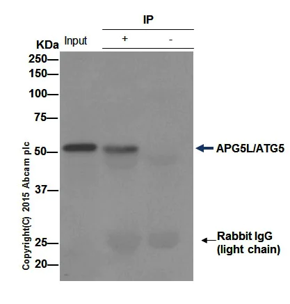 Immunoprecipitation - Anti-APG5L/ATG5 antibody [EPR1755(2)] - BSA and Azide free (AB221604)