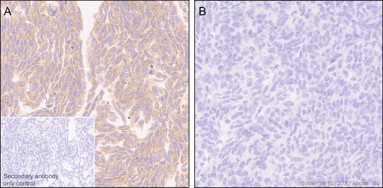Immunohistochemistry (Formalin/PFA-fixed paraffin-embedded sections) - Anti-APG5L/ATG5 antibody [EPR1755(2)] - Mouse IgG1 (Chimeric) (AB307842)