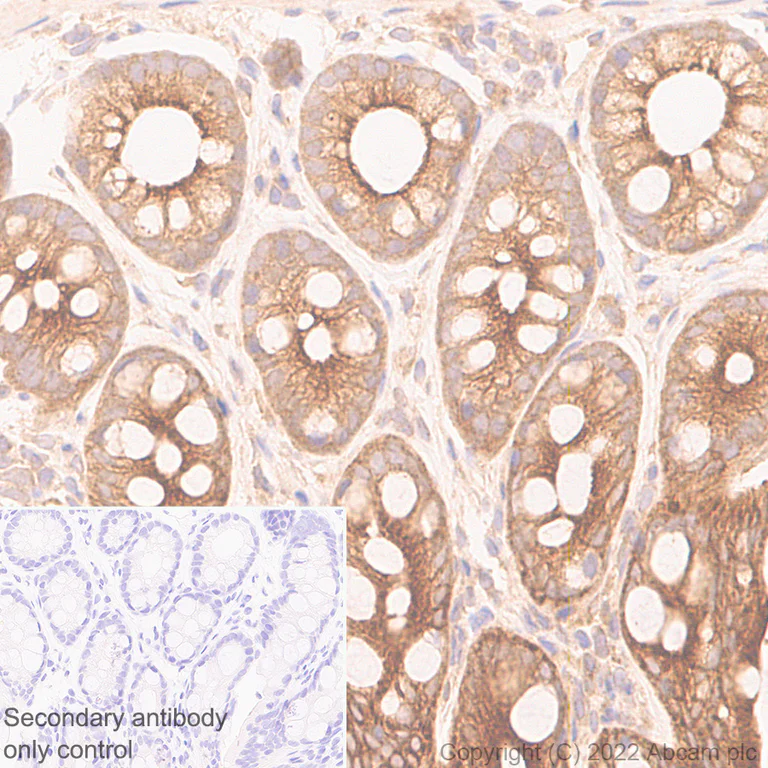 Immunohistochemistry (Formalin/PFA-fixed paraffin-embedded sections) - Anti-APG5L/ATG5 antibody [EPR1755(2)] - Mouse IgG1 (Chimeric) (AB307842)