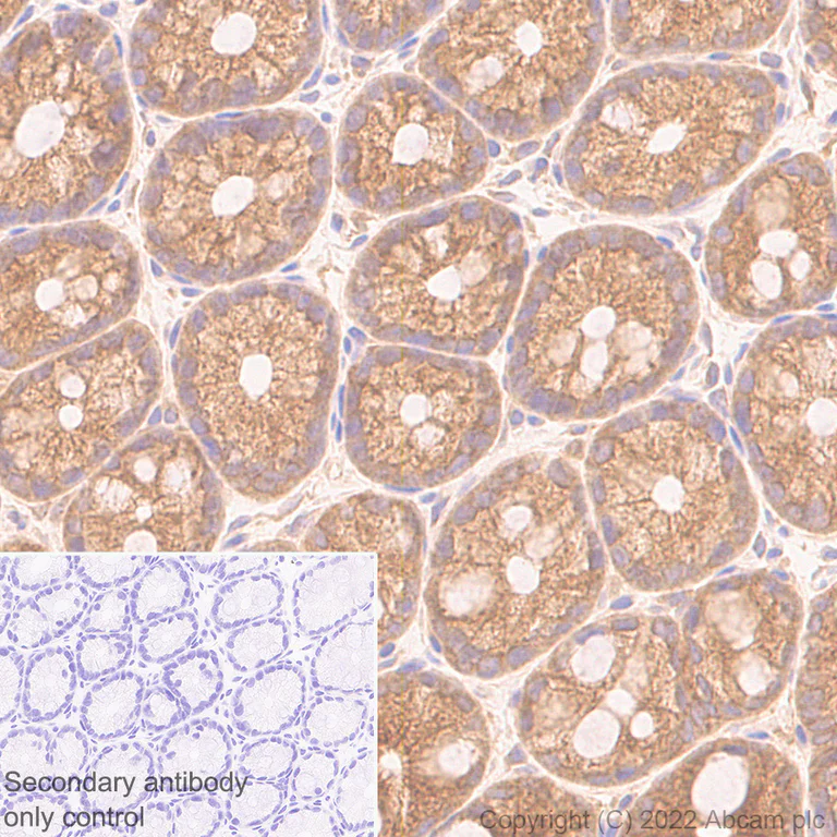 Immunohistochemistry (Formalin/PFA-fixed paraffin-embedded sections) - Anti-APG5L/ATG5 antibody [EPR1755(2)] - Mouse IgG1 (Chimeric) (AB307842)