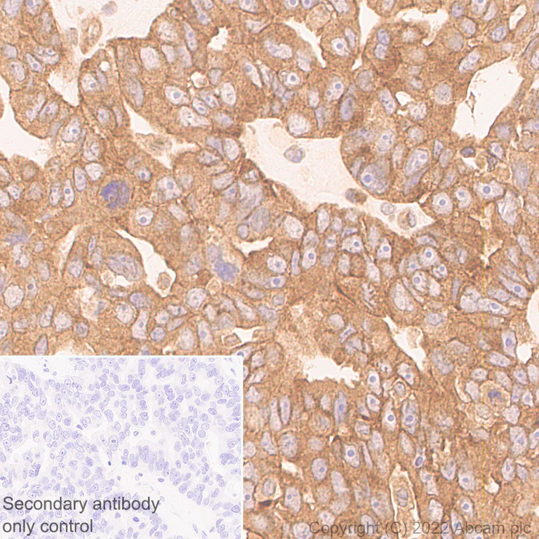 Immunohistochemistry (Formalin/PFA-fixed paraffin-embedded sections) - Anti-APG5L/ATG5 antibody [EPR1755(2)] - Mouse IgG1 (Chimeric) (AB307842)