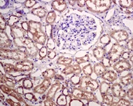 Immunohistochemistry (Formalin/PFA-fixed paraffin-embedded sections) - Anti-APG5L/ATG5 antibody [EPR4797] (AB109490)