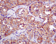 Immunohistochemistry (Formalin/PFA-fixed paraffin-embedded sections) - Anti-APG5L/ATG5 antibody [EPR4797] (AB109490), expandable thumbnail