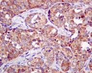 Immunohistochemistry (Formalin/PFA-fixed paraffin-embedded sections) - Anti-APG5L/ATG5 antibody [EPR4797] (AB109490)