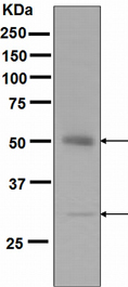 Western blot - Anti-APG5L/ATG5 antibody [EPR4797] (AB109490), expandable thumbnail