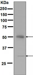 Western blot - Anti-APG5L/ATG5 antibody [EPR4797] (AB109490)